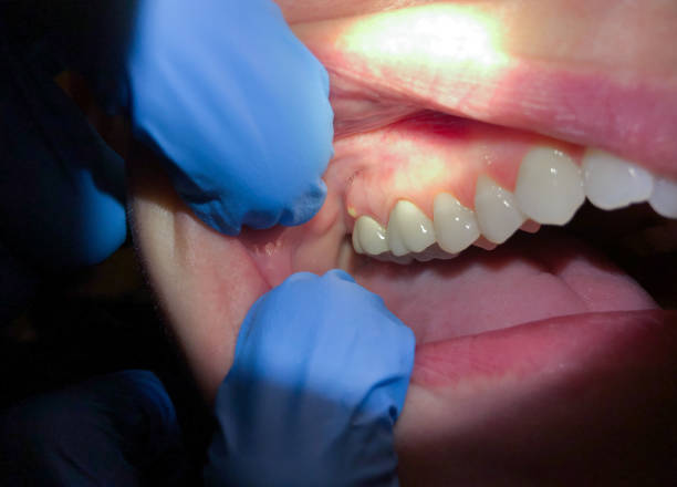 Best 24-Hour Emergency Dentist in Martinsvle, IL