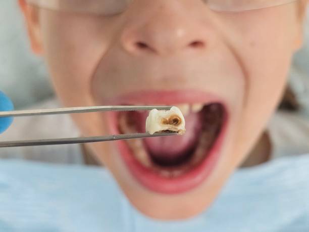 Best Emergency Orthodontic Repairs in Martinsvle, IL